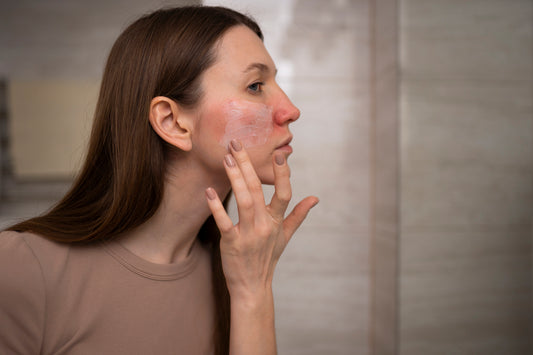 Exfoliante suave para piel con Rosácea